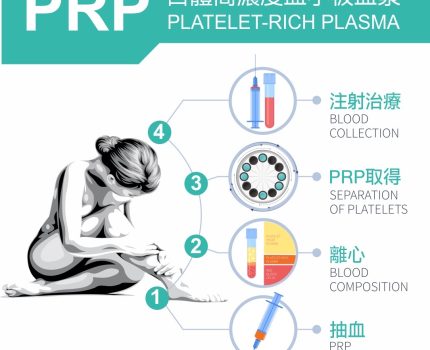 PRP治療費用全面解析：了解花費與價值