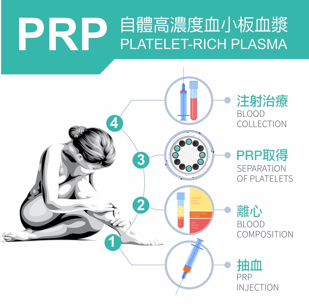 PRP治療費用全面解析：了解花費與價值