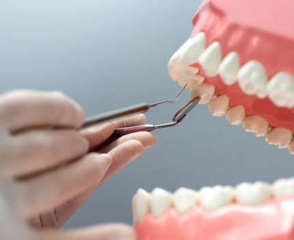 全口重建價位解析｜影響費用的5大關鍵因素